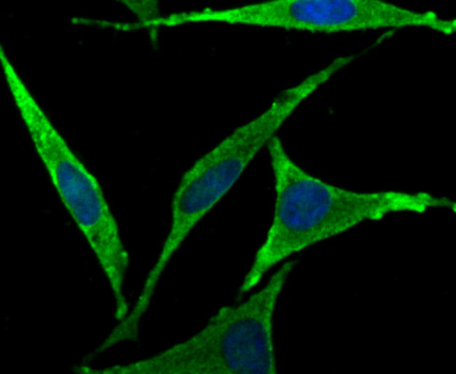 FOXO3A Antibody in Immunocytochemistry (ICC/IF)