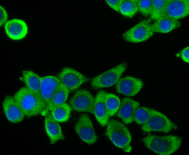 FOXO3A Antibody in Immunocytochemistry (ICC/IF)