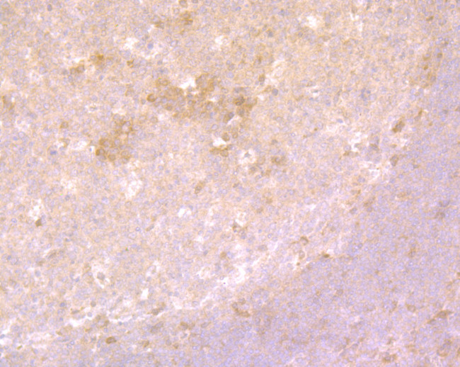 FOXO3A Antibody in Immunohistochemistry (Paraffin) (IHC (P))