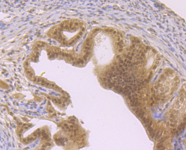 FOXO3A Antibody in Immunohistochemistry (Paraffin) (IHC (P))