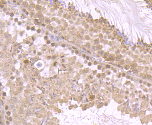 FOXO3A Antibody in Immunohistochemistry (Paraffin) (IHC (P))