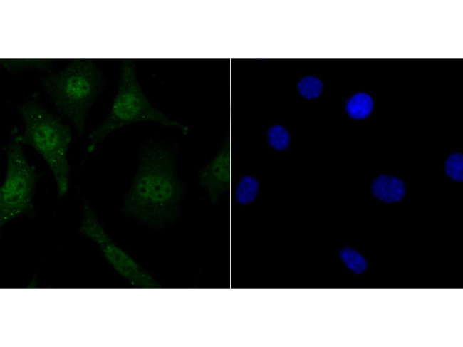 LSD1 Antibody in Immunocytochemistry (ICC/IF)