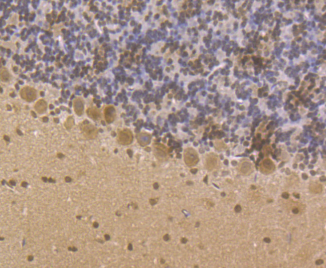 LSD1 Antibody in Immunohistochemistry (Paraffin) (IHC (P))