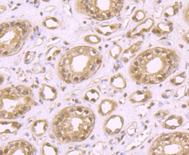 LSD1 Antibody in Immunohistochemistry (Paraffin) (IHC (P))