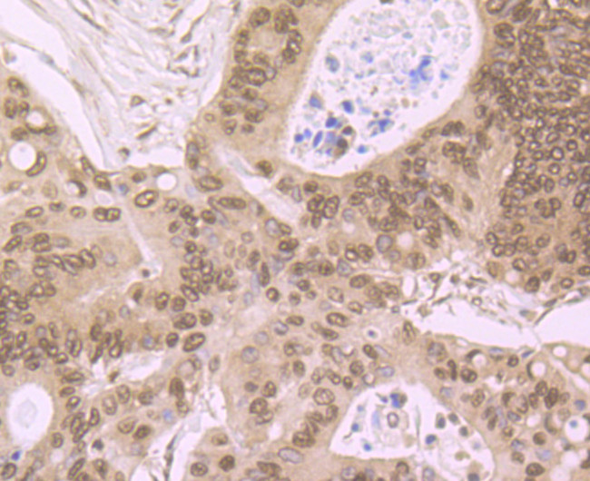 LSD1 Antibody in Immunohistochemistry (Paraffin) (IHC (P))