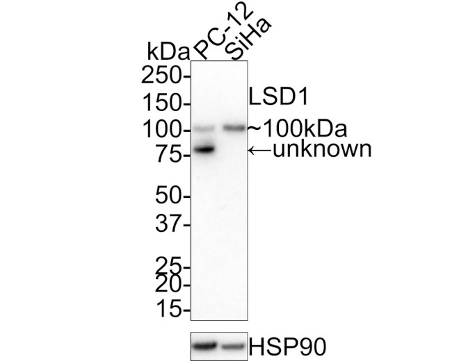 LSD1 Antibody in Western Blot (WB)