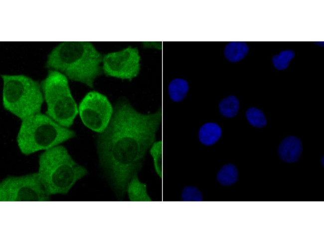 Progesterone Receptor Antibody in Immunocytochemistry (ICC/IF)