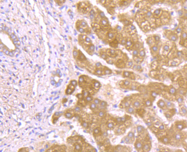 Alpha-1 acid glycoprotein Antibody in Immunohistochemistry (Paraffin) (IHC (P))