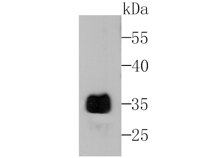 Alpha-1 acid glycoprotein Antibody in Western Blot (WB)