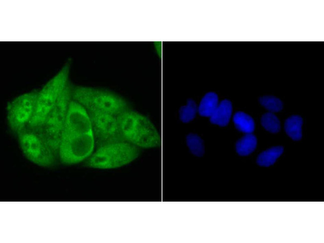 Progesterone Receptor Antibody in Immunocytochemistry (ICC/IF)