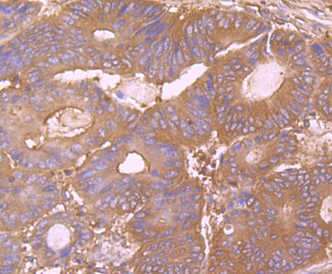 CD55 Antibody in Immunohistochemistry (Paraffin) (IHC (P))