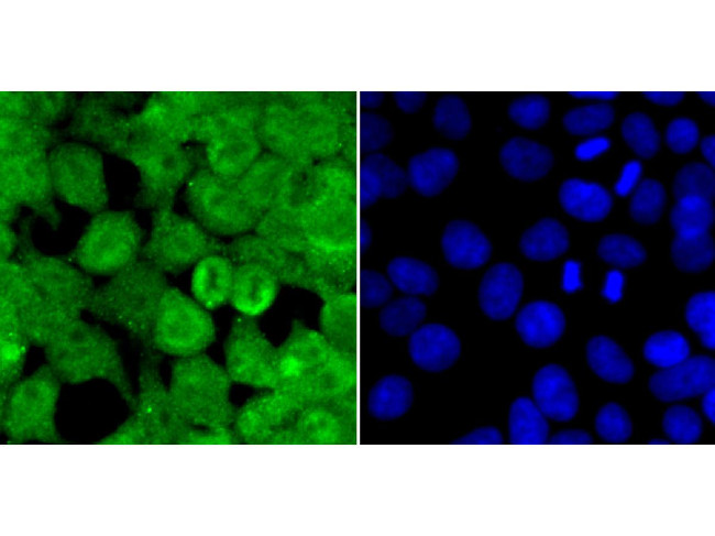 Dnmt3b Antibody in Immunocytochemistry (ICC/IF)