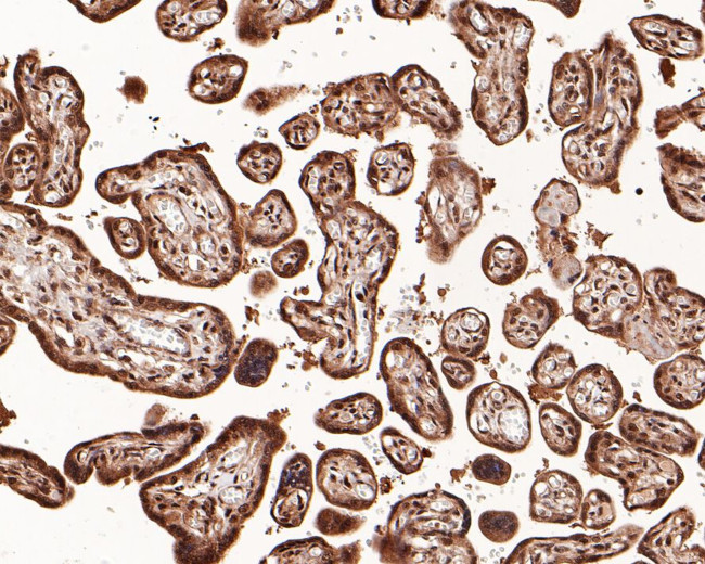 Dnmt3b Antibody in Immunohistochemistry (Paraffin) (IHC (P))