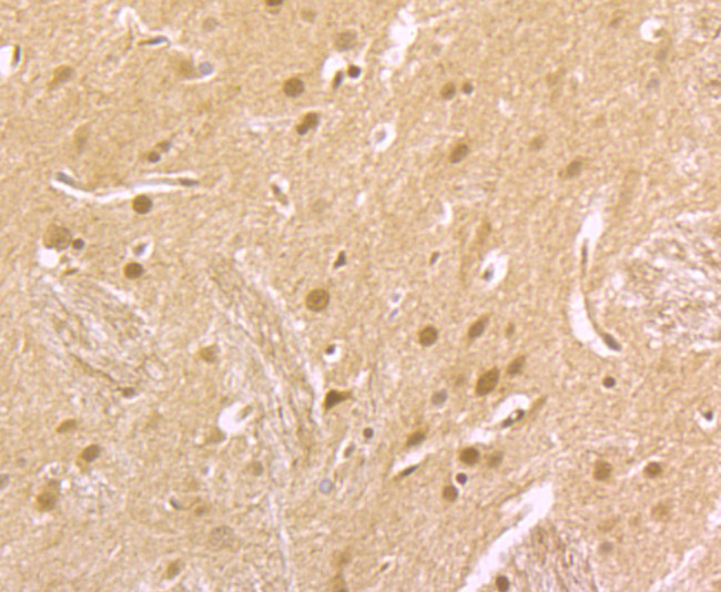 Dnmt3b Antibody in Immunohistochemistry (Paraffin) (IHC (P))