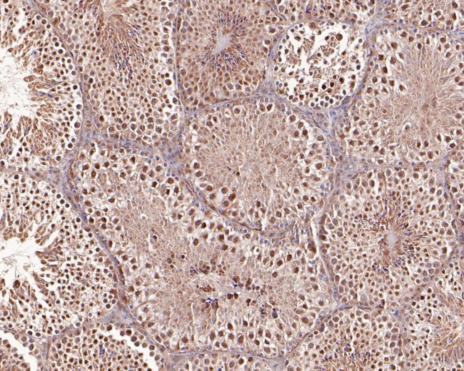 Dnmt3b Antibody in Immunohistochemistry (Paraffin) (IHC (P))