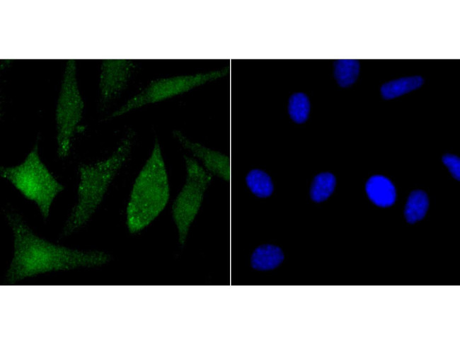 PARP1 Antibody in Immunocytochemistry (ICC/IF)