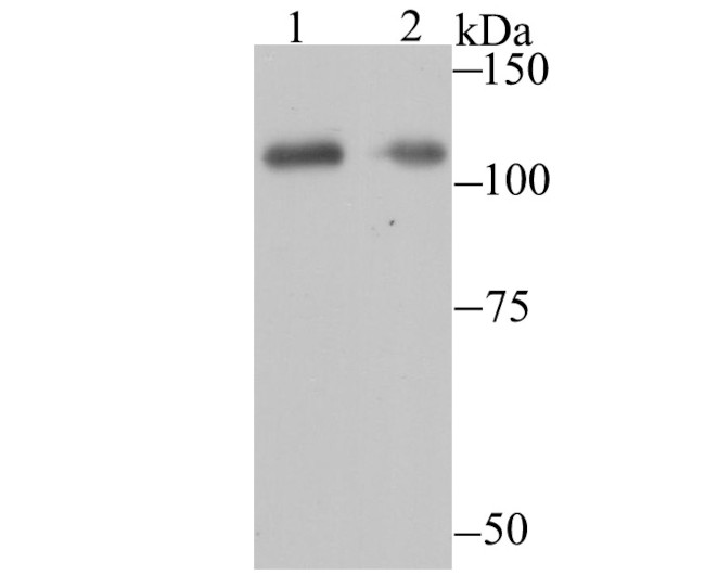 PARP1 Antibody in Western Blot (WB)