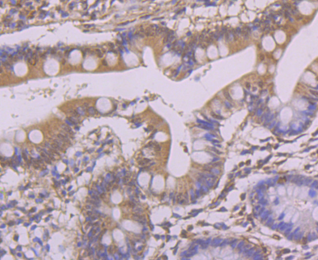 Apg3 Antibody in Immunohistochemistry (Paraffin) (IHC (P))