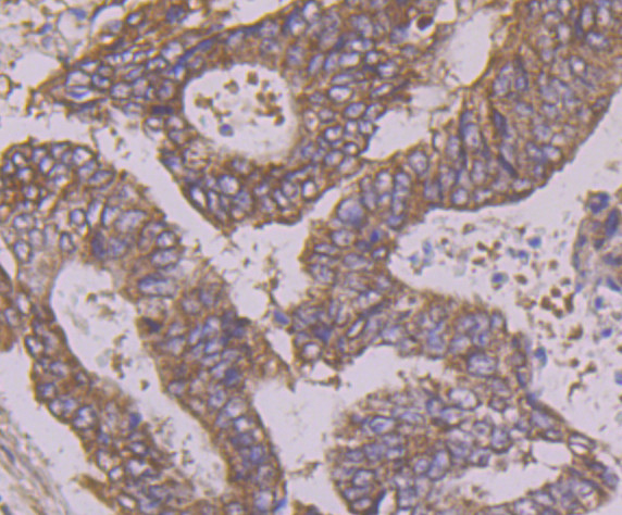 Apg3 Antibody in Immunohistochemistry (Paraffin) (IHC (P))