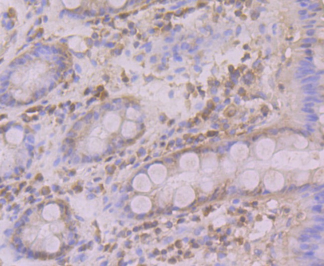 Atg12 Antibody in Immunohistochemistry (Paraffin) (IHC (P))