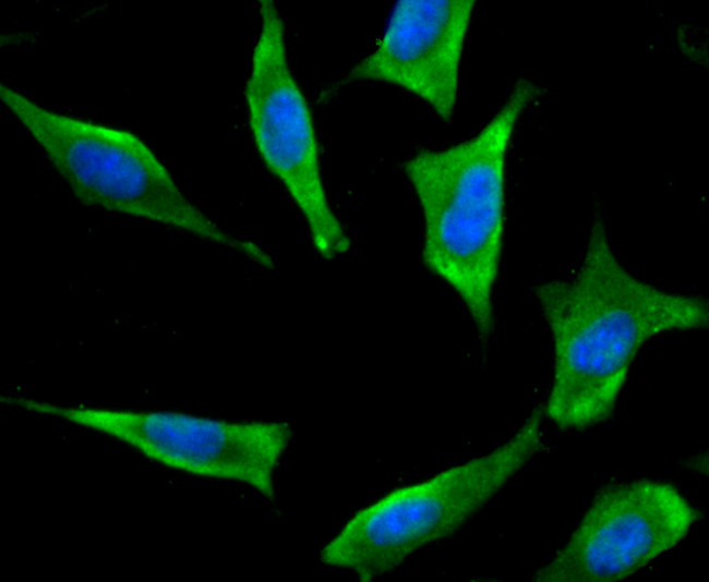 Bcl-2 Antibody in Immunocytochemistry (ICC/IF)