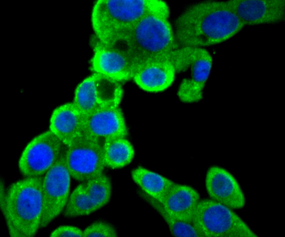 Bcl-2 Antibody in Immunocytochemistry (ICC/IF)