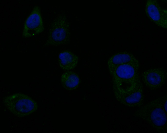 Tyk2 Antibody in Immunocytochemistry (ICC/IF)