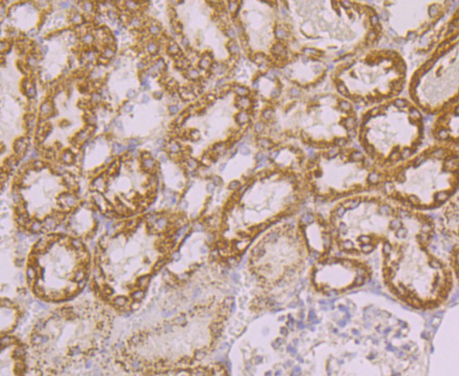 Tyk2 Antibody in Immunohistochemistry (Paraffin) (IHC (P))