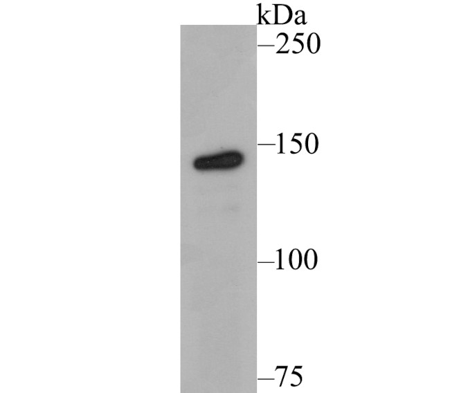 Tyk2 Antibody in Western Blot (WB)