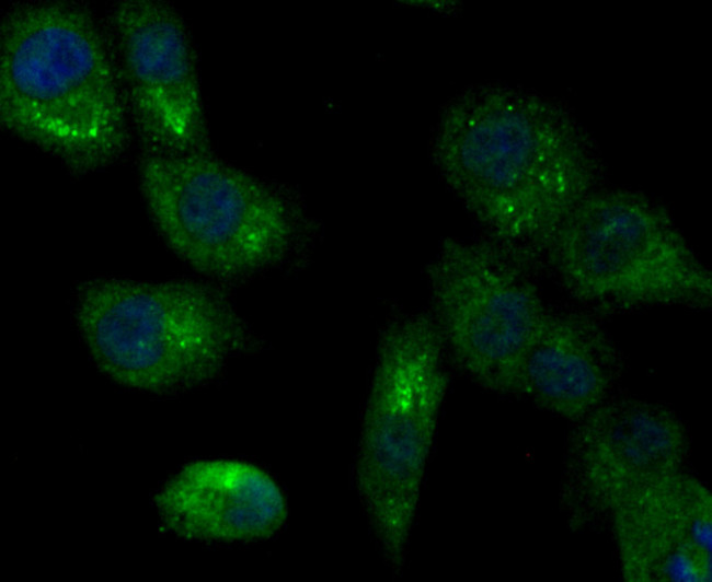 LOXL2 Antibody in Immunocytochemistry (ICC/IF)