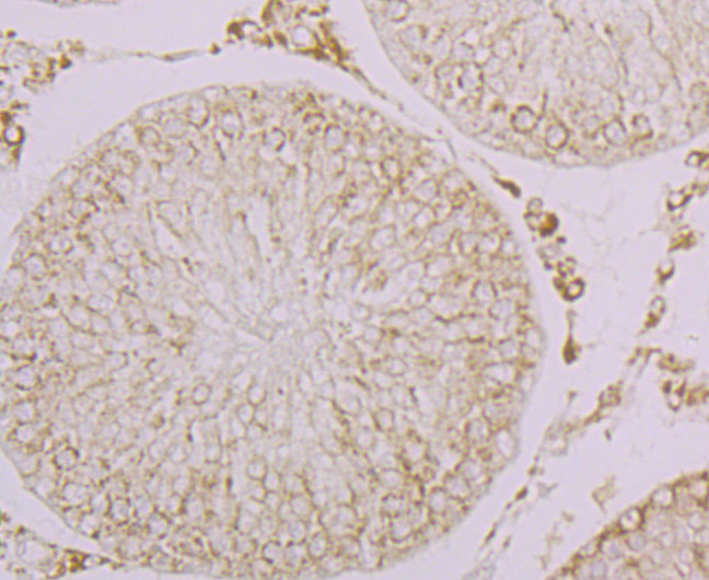 LOXL2 Antibody in Immunohistochemistry (Paraffin) (IHC (P))