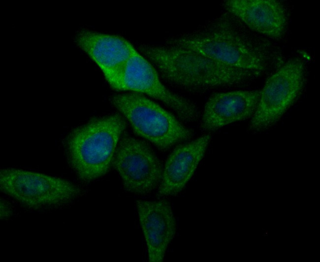 CASK Antibody in Immunocytochemistry (ICC/IF)