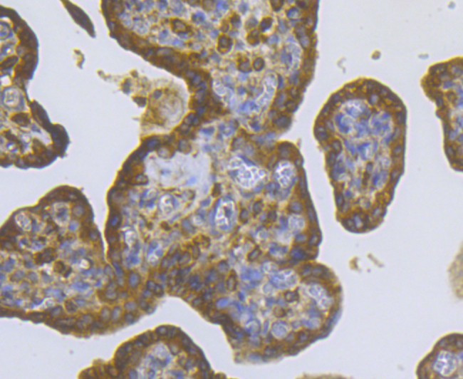 CASK Antibody in Immunohistochemistry (Paraffin) (IHC (P))