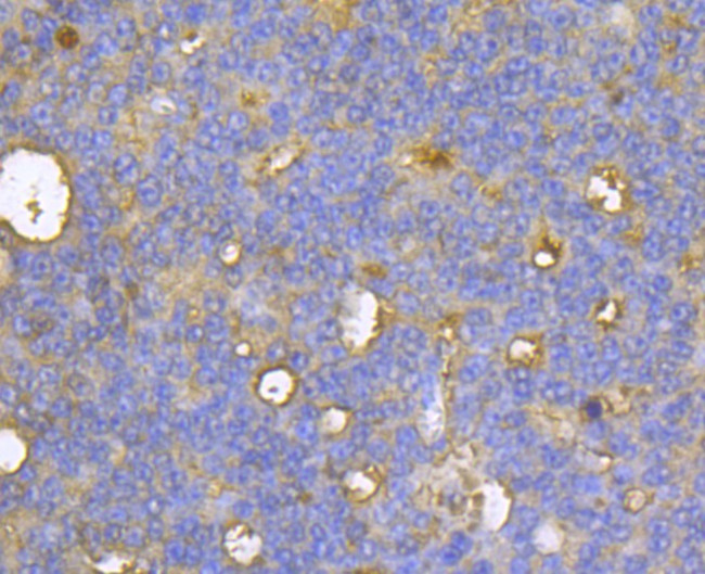 CASK Antibody in Immunohistochemistry (Paraffin) (IHC (P))