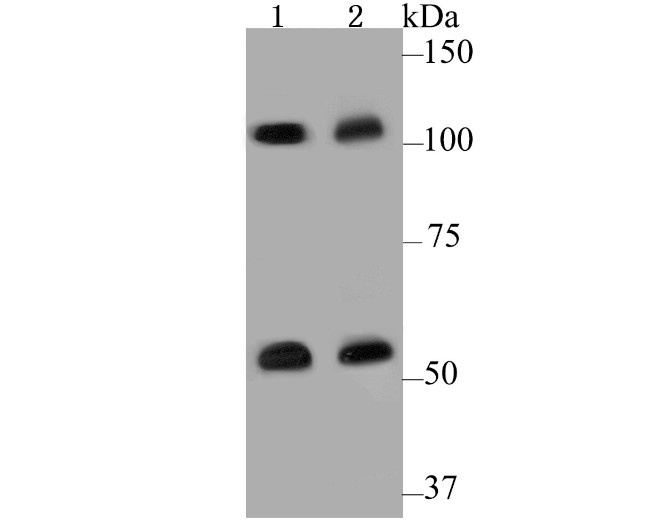 CASK Antibody in Western Blot (WB)