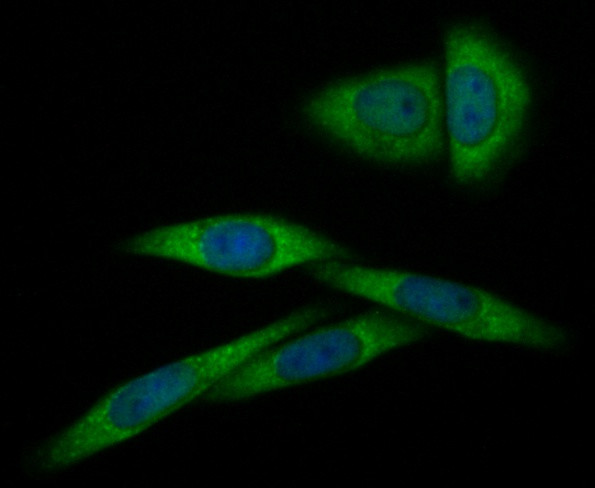 Annexin A1 Antibody in Immunocytochemistry (ICC/IF)