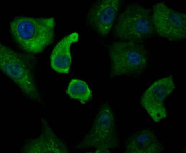 Annexin A1 Antibody in Immunocytochemistry (ICC/IF)