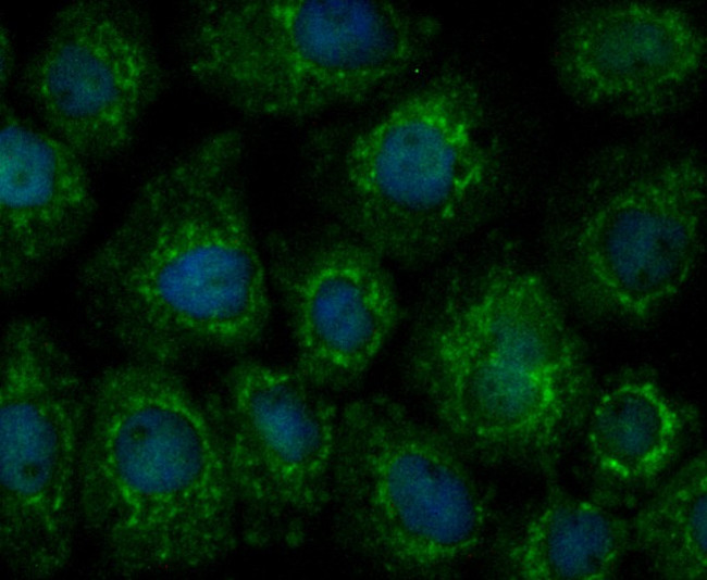 Annexin A1 Antibody in Immunocytochemistry (ICC/IF)