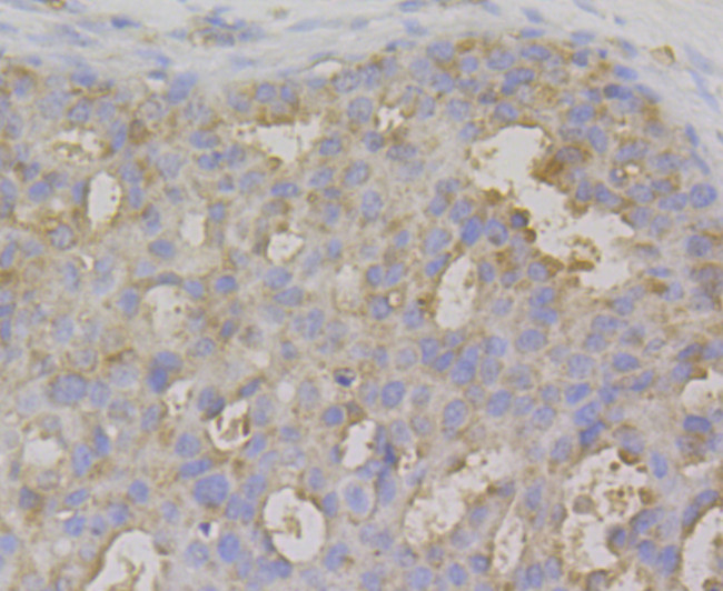 IL-22 Antibody in Immunohistochemistry (Paraffin) (IHC (P))