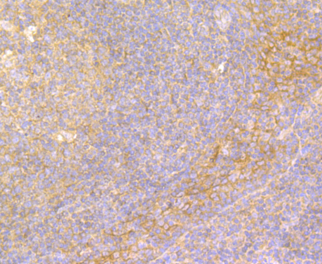 IL-22 Antibody in Immunohistochemistry (Paraffin) (IHC (P))