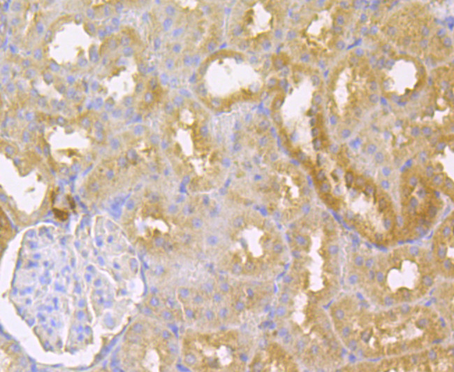 IL-22 Antibody in Immunohistochemistry (Paraffin) (IHC (P))