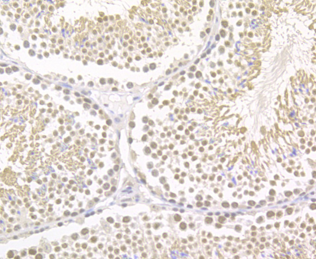 Brd4 Antibody in Immunocytochemistry (ICC/IF)