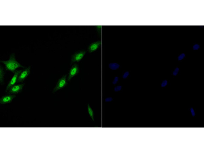 Brd4 Antibody in Immunocytochemistry (ICC/IF)