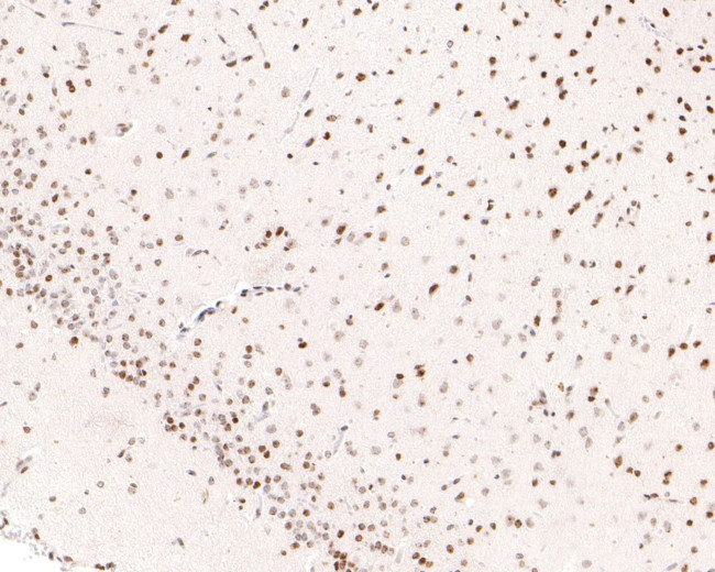 Brd4 Antibody in Immunohistochemistry (Paraffin) (IHC (P))