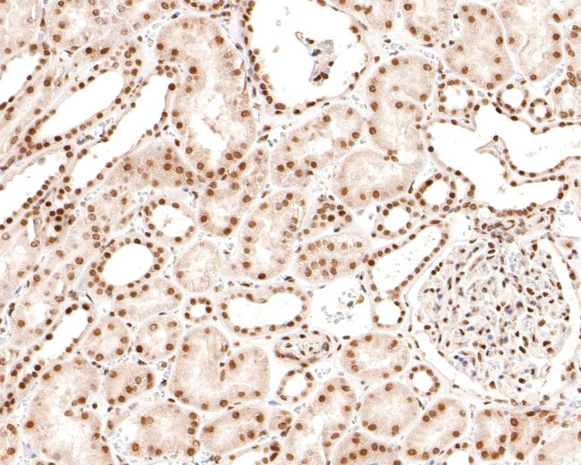 Brd4 Antibody in Immunohistochemistry (Paraffin) (IHC (P))