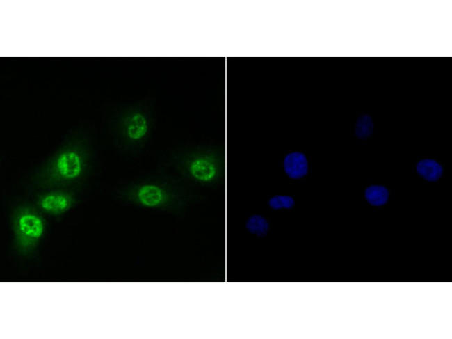 Brd4 Antibody in Western Blot (WB)