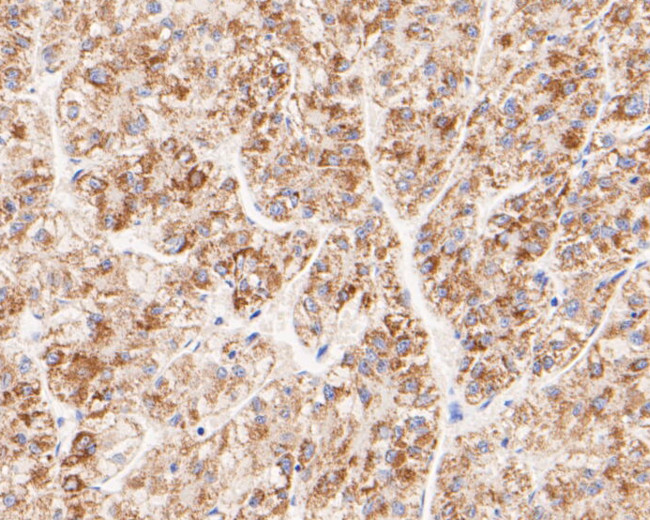 FH Antibody in Immunocytochemistry (ICC/IF)