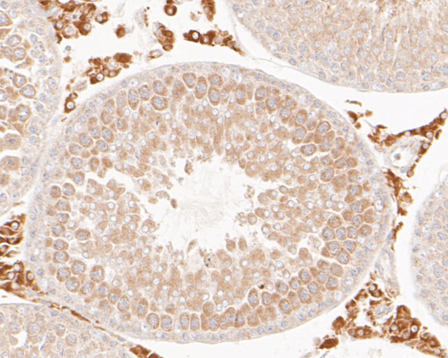 FH Antibody in Immunocytochemistry (ICC/IF)