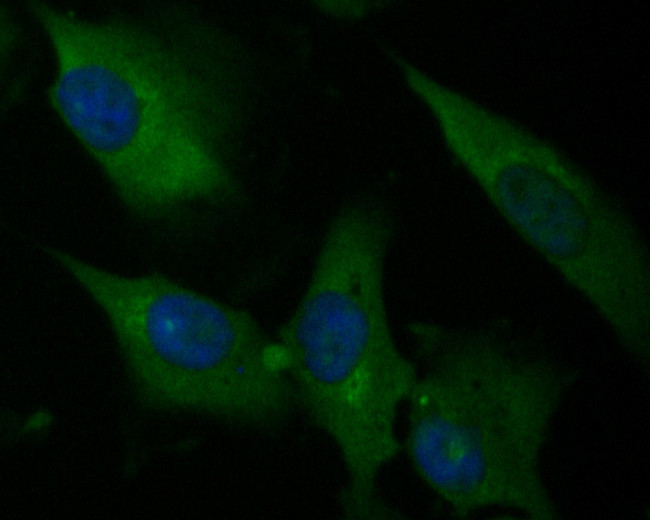 P2X7 Antibody in Immunocytochemistry (ICC/IF)