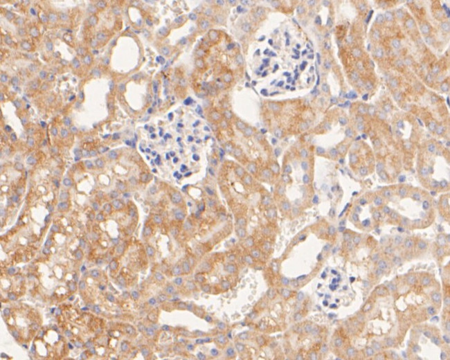 P2X7 Antibody in Immunohistochemistry (Paraffin) (IHC (P))